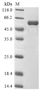 [Cusabio] Recombinant Rat E3 ubiquitin-protein ligase parkin (Park2)