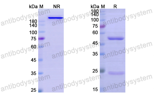 [Antibodysystem] Research Grade Anti-Human CD22 (M972)