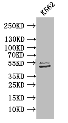 [Cusabio] TUBB1 Recombinant Monoclonal Antibody