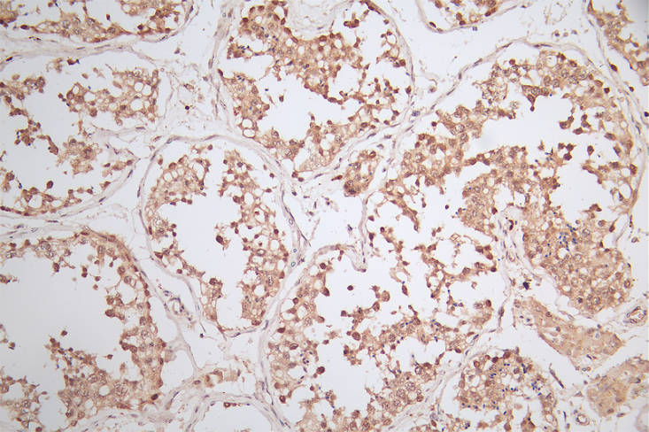 [Cusabio] WDR5 Recombinant Monoclonal Antibody