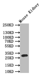 [Cusabio] TPSB2 Recombinant Monoclonal Antibody