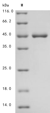 [Cusabio] Recombinant Human Keratin, type I cytoskeletal 19 I (KRT19)