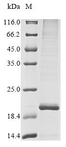 [Cusabio] Recombinant Human Sal-like protein 4 (SALL4), partial