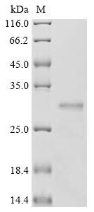 [Cusabio] Recombinant Human Erythroferrone (ERFE), partial