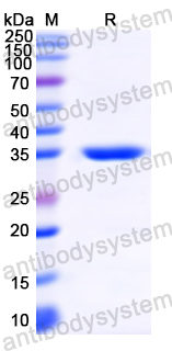 [Antibodysystem] Recombinant MARV VP40/Marburg VP40 Protein, N-His