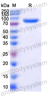 [Antibodysystem] Recombinant MARV NP/Nucleoprotein Protein, N-His