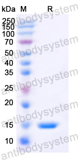 [Antibodysystem] Recombinant MARV GP2/Envelope glycoprotein 2 Protein, N-His