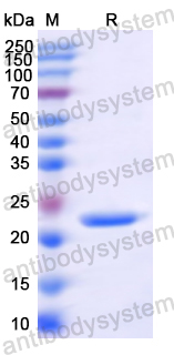 [Antibodysystem] Recombinant MARV GP1/Envelope glycoprotein 1 Protein, N-His