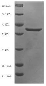 [Cusabio] Recombinant Human DNA dC->dU-editing enzyme APOBEC-3A (APOBEC3A)