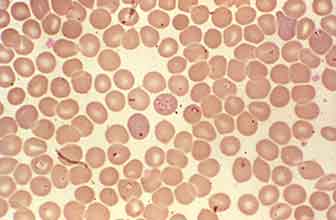 Babesia canis