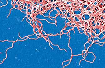 Borrelia garinii, Borrelia afzelii and Borrelia burgdorferi