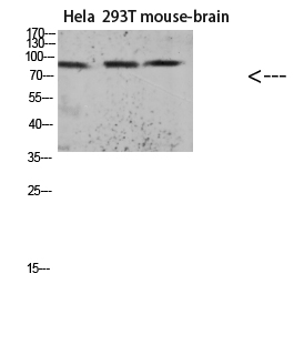 Tau (Acetyl Lys174) Polyclonal Antibody - SAB | Signalway Antibody