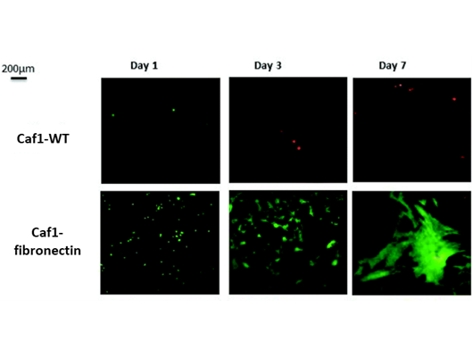 Fibronectin