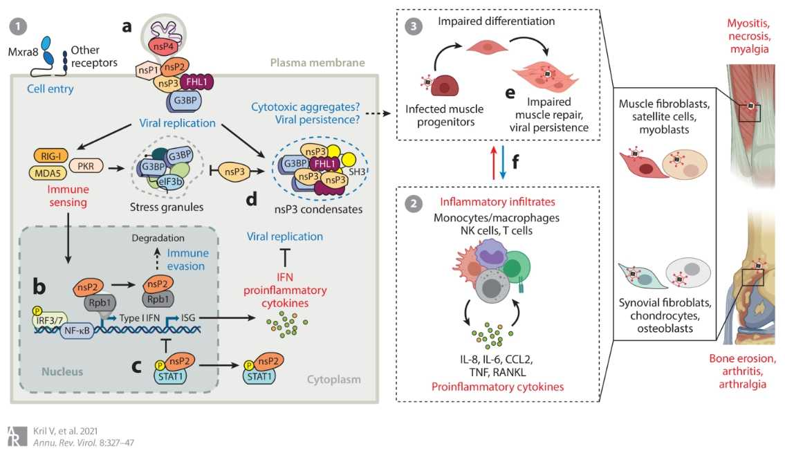 Model of Muscle and Joint Pathogenesis Induced by CHIKV (Kri V, 2021)