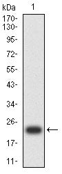 설명: Figure 2:Western blot analysis using SV2C mAb against human SV2C (AA: extra mix) recombinant protein. (Expected MW is 22.7 kDa)
