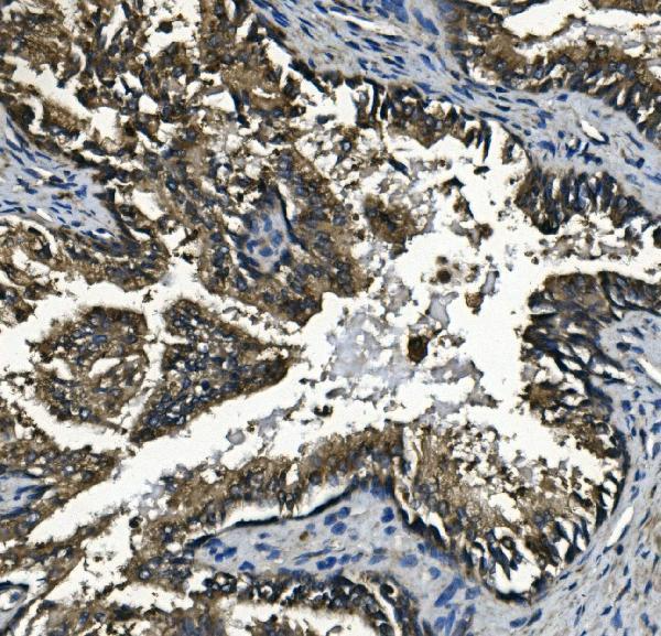 m01548 gaa primary antibodies ihc testing 4_1 m01548 gaa primary antibodies ihc testing 4_1