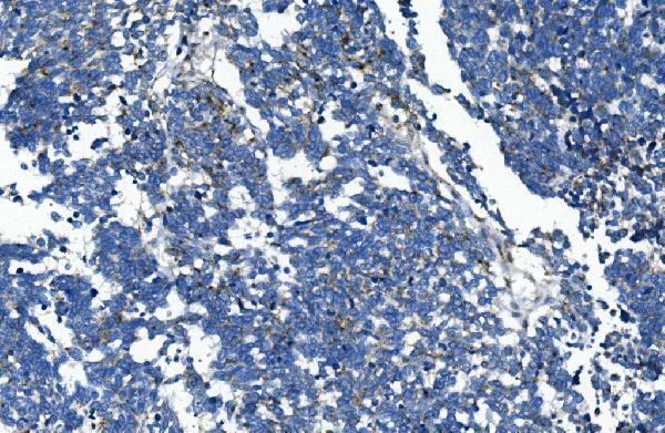 m01548 gaa primary antibodies ihc testing 2_1 m01548 gaa primary antibodies ihc testing 2_1