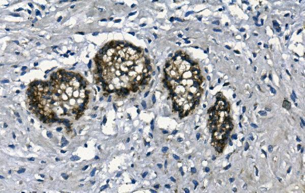 m01548 gaa primary antibodies ihc testing 3_1 m01548 gaa primary antibodies ihc testing 3_1