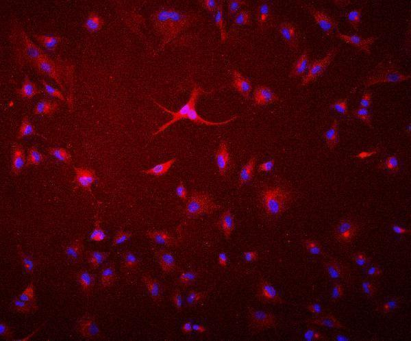 m01548 gaa primary antibodies if testing 6_2 m01548 gaa primary antibodies if testing 6_2