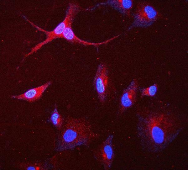 m01548 gaa primary antibodies if testing 5_2 m01548 gaa primary antibodies if testing 5_2